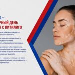 25 июня во всем мире отмечают День борьбы с витилиго