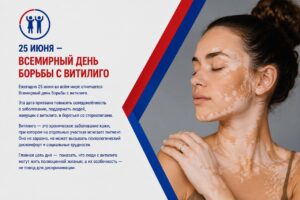 25 июня во всем мире отмечают День борьбы с витилиго
